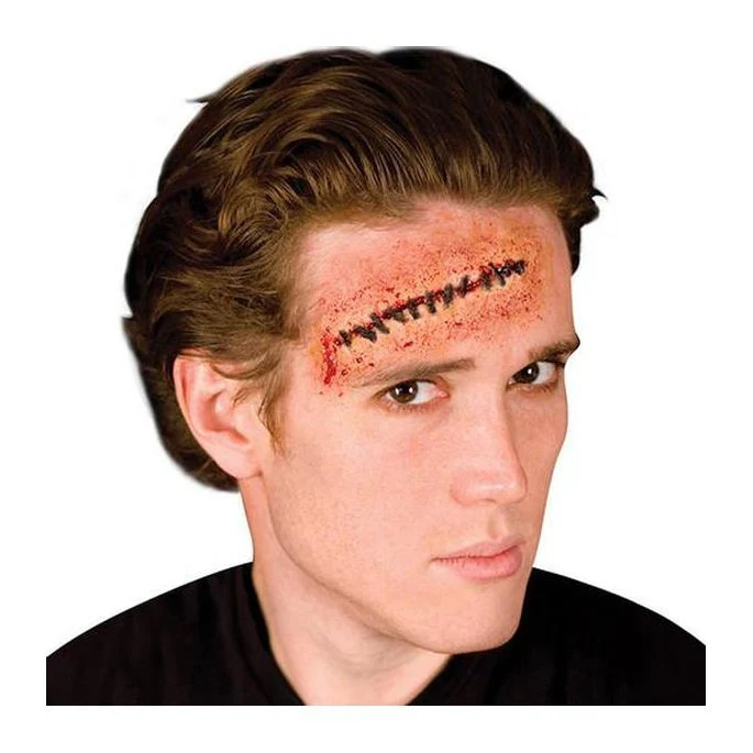 Stitches